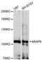 A-kinase anchor protein 6 antibody, LS-C747866, Lifespan Biosciences, Western Blot image 