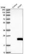 POP7 Homolog, Ribonuclease P/MRP Subunit antibody, NBP1-92282, Novus Biologicals, Western Blot image 