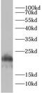 hAG-2 antibody, FNab10447, FineTest, Western Blot image 