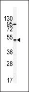 Gastric Inhibitory Polypeptide Receptor antibody, LS-C99946, Lifespan Biosciences, Western Blot image 