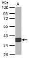 Aldo-Keto Reductase Family 1 Member D1 antibody, LS-C155293, Lifespan Biosciences, Western Blot image 