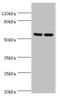 Protein Kinase AMP-Activated Non-Catalytic Subunit Gamma 3 antibody, orb352544, Biorbyt, Western Blot image 