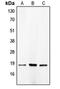 Cyclin-dependent kinase 4 inhibitor C antibody, orb213720, Biorbyt, Western Blot image 