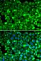 Ribosomal Protein Lateral Stalk Subunit P1 antibody, orb373460, Biorbyt, Immunocytochemistry image 