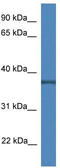 CXXC Finger Protein 5 antibody, TA344189, Origene, Western Blot image 