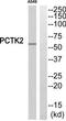 Cyclin-dependent kinase 17 antibody, TA314325, Origene, Western Blot image 