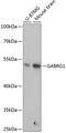 Gamma-Aminobutyric Acid Type A Receptor Gamma1 Subunit antibody, 15-444, ProSci, Western Blot image 