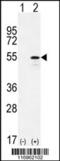 Cytochrome P450 Family 26 Subfamily B Member 1 antibody, 63-323, ProSci, Western Blot image 