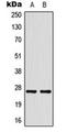 Heat Shock Protein Family B (Small) Member 1 antibody, orb216130, Biorbyt, Western Blot image 