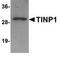 NSA2 Ribosome Biogenesis Factor antibody, TA306966, Origene, Western Blot image 