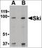 SKI Proto-Oncogene antibody, orb86750, Biorbyt, Western Blot image 