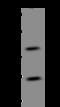 ATM Interactor antibody, 206550-T32, Sino Biological, Western Blot image 