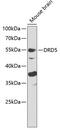 Dopamine Receptor D5 antibody, 16-882, ProSci, Western Blot image 