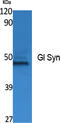 Glutamate-Ammonia Ligase antibody, STJ96400, St John