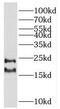Ras Homolog Family Member F, Filopodia Associated antibody, FNab07285, FineTest, Western Blot image 