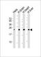 Superoxide Dismutase 2 antibody, M33970, Boster Biological Technology, Western Blot image 