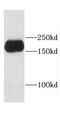 Cep170-like protein antibody, FNab01599, FineTest, Western Blot image 