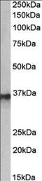 Heterogeneous Nuclear Ribonucleoprotein A2/B1 antibody, MBS423363, MyBioSource, Western Blot image 