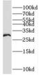 Monoacylglycerol O-Acyltransferase 2 antibody, FNab05270, FineTest, Western Blot image 
