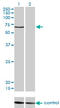 Calcium Voltage-Gated Channel Auxiliary Subunit Beta 1 antibody, LS-C196800, Lifespan Biosciences, Western Blot image 