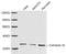 Gap Junction Protein Beta 1 antibody, LS-C203119, Lifespan Biosciences, Western Blot image 