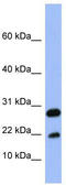 A-FABP antibody, TA334271, Origene, Western Blot image 
