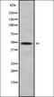 Carcinoembryonic Antigen Related Cell Adhesion Molecule 16 antibody, orb338139, Biorbyt, Western Blot image 