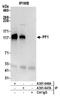 PHD finger protein 12 antibody, A301-647A, Bethyl Labs, Immunoprecipitation image 