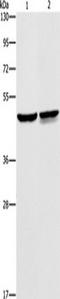 Alpha-Methylacyl-CoA Racemase antibody, TA349234, Origene, Western Blot image 