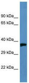 Opsin 1, Medium Wave Sensitive antibody, TA342729, Origene, Western Blot image 