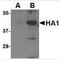 Influenza A Virus Hemagglutinin  antibody, PA1-23094, Invitrogen Antibodies, Western Blot image 