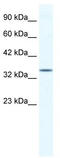 Zinc Finger Protein 589 antibody, TA331930, Origene, Western Blot image 