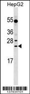 Leucine Rich Repeat Containing 29 antibody, 59-417, ProSci, Western Blot image 