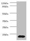 Phosphohistidine Phosphatase 1 antibody, A53656-100, Epigentek, Western Blot image 