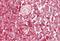 WAS antibody, NB300-996, Novus Biologicals, Immunohistochemistry paraffin image 