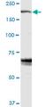 Zinc Finger FYVE-Type Containing 9 antibody, H00009372-D01P, Novus Biologicals, Western Blot image 
