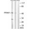 DNA Primase Subunit 1 antibody, A09694, Boster Biological Technology, Western Blot image 