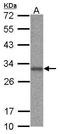 Acidic Nuclear Phosphoprotein 32 Family Member B antibody, PA5-30390, Invitrogen Antibodies, Western Blot image 