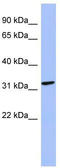 MAGE Family Member B2 antibody, TA337655, Origene, Western Blot image 