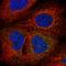 Armadillo Like Helical Domain Containing 3 antibody, HPA053580, Atlas Antibodies, Immunocytochemistry image 
