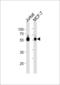 Zinc Finger And SCAN Domain Containing 32 antibody, LS-C203995, Lifespan Biosciences, Western Blot image 