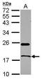 Ribonuclease pancreatic antibody, GTX105623, GeneTex, Western Blot image 
