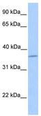 Layilin antibody, TA337582, Origene, Western Blot image 