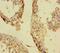 Polyhomeotic-like protein 1 antibody, orb43913, Biorbyt, Immunohistochemistry paraffin image 