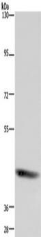 Forkhead Box D4 antibody, TA350670, Origene, Western Blot image 