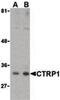 Complement C1q tumor necrosis factor-related protein 1 antibody, PA5-20145, Invitrogen Antibodies, Western Blot image 