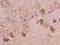 Metastasis-suppressor KiSS-1 antibody, orb10955, Biorbyt, Immunohistochemistry paraffin image 
