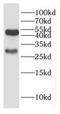 Galactosylceramidase antibody, FNab03307, FineTest, Western Blot image 