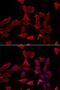 Adenylosuccinate synthetase isozyme 2 antibody, LS-C747504, Lifespan Biosciences, Immunofluorescence image 