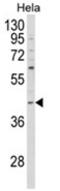 NCK Adaptor Protein 1 antibody, AP18125PU-N, Origene, Western Blot image 